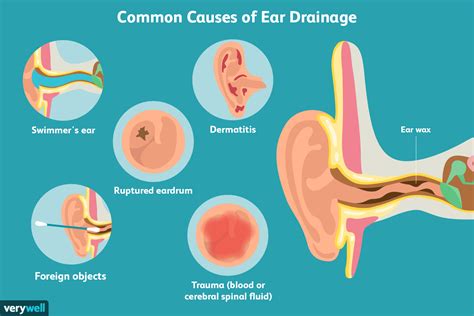 ear leaking clear fluid no pain|Clear Fluid Ear Discharge: Causes and Treatment Options